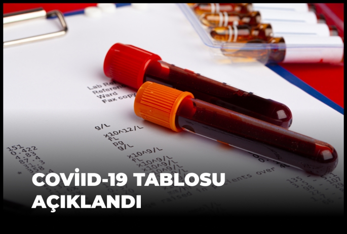 KKTC'de Haftalık Korona Tablosu